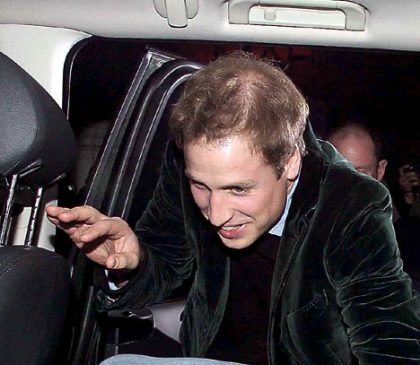 prince william balding. that Prince William would